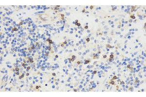Immunohistochemistry analysis of paraffin-embedded mouse spleen using THY1 Polyclonal Antibody at dilution of 1:500. (CD90 antibody)