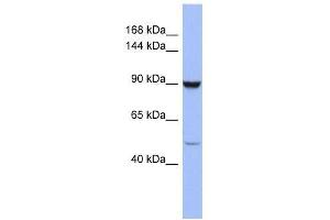 ZFP28 antibody used at 0. (ZFP28 antibody  (Middle Region))