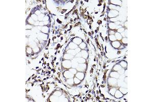Immunohistochemistry (IHC) image for anti-Toll-Like Receptor 8 (TLR8) (AA 849-1041) antibody (ABIN3022015)