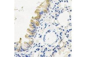 Immunohistochemical analysis of RANBP5 staining in mouse lung formalin fixed paraffin embedded tissue section. (Importin 5 antibody)