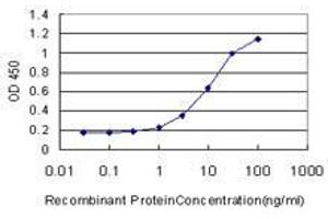 Detection limit for recombinant GST tagged ZBTB16 is approximately 1ng/ml as a capture antibody. (ZBTB16 antibody  (AA 381-480))