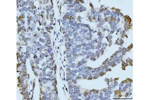 IHC analysis of ARL6IP6 using anti-ARL6IP6 antibody (ABIN7603020). (ARL6IP6 antibody  (Middle Region))