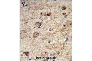 Formalin-fixed and paraffin-embedded human brain tissue reacted with LRRC4 Antibody (C-term), which was peroxidase-conjugated to the secondary antibody, followed by DAB staining. (LRRC4 antibody  (C-Term))