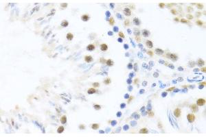 Immunohistochemistry of paraffin-embedded Rat testis using DDX46 Polyclonal Antibody at dilution of 1:100 (40x lens).