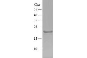 GCET2 Protein (AA 1-178) (His tag)