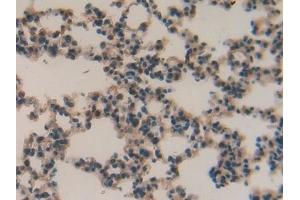 Detection of MMP12 in Mouse Lung Tissue using Polyclonal Antibody to Matrix Metalloproteinase 12 (MMP12) (MMP12 antibody  (AA 294-473))