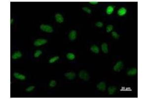 Immunostaining analysis in HeLa cells. (DDB2 antibody)
