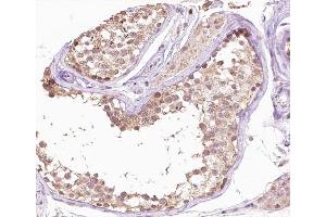 ABIN6266658 at 1/100 staining human testis tissue sections by IHC-P. (SENP6 antibody  (Internal Region))