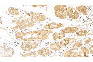 Detection of CDKN1A in Human Stomach Tissue using Polyclonal Antibody to Cyclin Dependent Kinase Inhibitor 1A (CDKN1A) (p21 antibody  (AA 1-164))