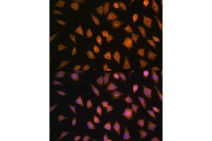 Immunofluorescence analysis of L929 cells using ELOVL4 Rabbit pAb (ABIN1679709, ABIN3017923, ABIN3017924 and ABIN6220305) at dilution of 1:100. (ELOVL4 antibody  (AA 1-100))