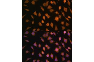 Immunofluorescence analysis of L929 cells using ELOVL4 Rabbit pAb (ABIN1679709, ABIN3017923, ABIN3017924 and ABIN6220305) at dilution of 1:100. (ELOVL4 antibody  (AA 1-100))