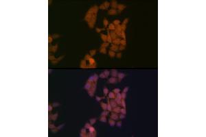 Immunofluorescence analysis of HeLa cells using Kaiso/ZBTB33 Rabbit mAb (ABIN7271437) at dilution of 1:100 (40x lens). (ZBTB33 antibody)