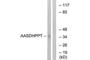 Western blot analysis of extracts from COLO cells, using AASDHPPT Antibody. (AASDHPPT antibody  (AA 11-60))