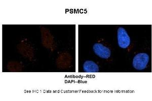 Sample Type :  Human brain stem cells  Primary Antibody Dilution :  1:500  Secondary Antibody :  Goat anti-rabbit Alexa-Fluor 594  Secondary Antibody Dilution :  1:1000  Color/Signal Descriptions :  PSMC5: Red DAPI:Blue  Gene Name :  PSMC5  Submitted by :  Dr. (PSMC5 antibody  (C-Term))