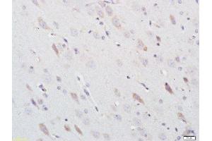 Paraformaldehyde-fixed, paraffin embedded rat brain, Antigen retrieval by boiling in sodium citrate buffer (pH6) for 15min, Block endogenous peroxidase by 3% hydrogen peroxide for 30 minutes, Blocking buffer (normal goat serum) at 37°C for 20min, Antibody incubation with Nitrotyrosine Polyclonal Antibody, Unconjugated  at 1:200 overnight at 4°C, followed by a conjugated secondary and DAB staining. (Nitrotyrosine antibody)