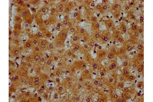IHC image of ABIN7164105 diluted at 1:600 and staining in paraffin-embedded human liver tissue performed on a Leica BondTM system.