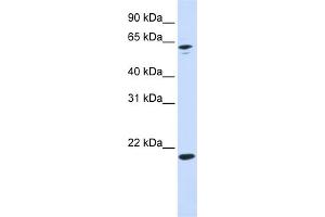 WB Suggested Anti-APRT Antibody Titration: 0. (APRT antibody  (N-Term))