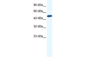 WB Suggested Anti-ZNF239 Antibody Titration:  0.