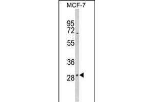 Western blot analysis of DIO2 Antibody (Center) (ABIN652664 and ABIN2842445) in MCF-7 cell line lysates (35 μg/lane). (DIO2 antibody  (AA 165-191))