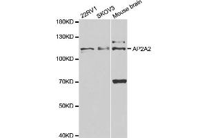Western blot analysis of extracts of various cell lines, using AP2A2 antibody (ABIN5973124) at 1/1000 dilution. (AP2A2 antibody)