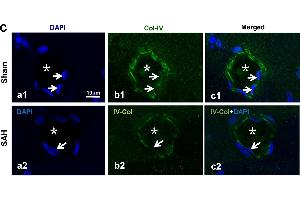 The molecules involved in IPAD impairment after SAH. (COL4a3 antibody  (AA 1571-1670))