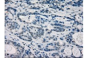 Immunohistochemical staining of paraffin-embedded endometrium tissue using anti-FRKmouse monoclonal antibody. (FRK antibody)