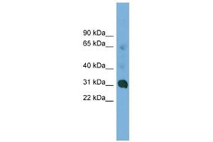 CCDC127 antibody used at 1 ug/ml to detect target protein. (CCDC127 antibody  (N-Term))