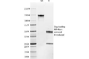 SDS-PAGE Analysis Purified CD117 Mouse Monoclonal Antibody (C117/370). (KIT antibody)