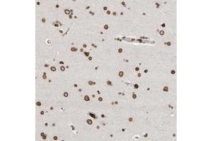 Immunohistochemical staining of human cerebral cortex with CDCA2 polyclonal antibody  shows strong nuclear and nuclear membrane positivity in neurons and glial cells. (CDCA2 antibody)