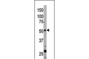 The anti-BECN1 Pab (ABIN388545 and ABIN2849691) is used in Western blot to detect BECN1 in mouse liver tissue lysate. (Beclin 1 antibody  (AA 181-210))