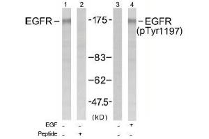 Image no. 1 for anti-Epidermal Growth Factor Receptor (EGFR) (Tyr1197) antibody (ABIN197463) (EGFR antibody  (Tyr1197))