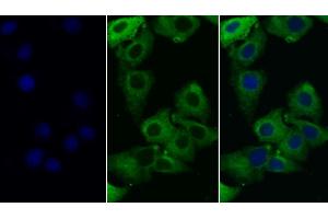 Detection of TLR8 in Human Hela cell using Monoclonal Antibody to Toll Like Receptor 8 (TLR8) (TLR8 antibody  (AA 844-1039))