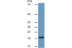 Rabbit Capture antibody from the kit in WB with Positive Control: Sample Human brain lysate. (Pleiotrophin ELISA Kit)