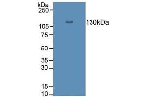 Detection of DSG3 in Porcine Skin Tissue using Polyclonal Antibody to Desmoglein 3 (DSG3)