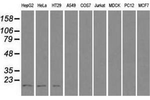 Western blot analysis of extracts (35 µg) from 9 different cell lines by using anti-CTAG1B monoclonal antibody. (CTAG1B antibody)