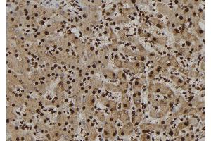 ABIN6277227 at 1/100 staining Human liver tissue by IHC-P. (NUP62 antibody  (Internal Region))
