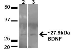 Western blot analysis of Human HeLa and HEK293T cell lysates showing detection of ~27. (BDNF antibody  (N-Term) (Alkaline Phosphatase (AP)))