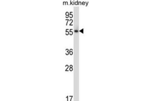 Western Blotting (WB) image for anti-Polo-Like Kinase 5 (PLK5) antibody (ABIN2997865)