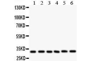 Anti- CASP3 antibody, Western blotting All lanes: Anti CASP3  at 0. (Caspase 3 antibody  (C-Term))