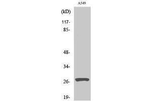 Western Blotting (WB) image for anti-Cathepsin D (CTSD) (cleaved), (Heavy Chain), (Leu169) antibody (ABIN3181790) (Cathepsin D antibody  (cleaved, Heavy Chain, Leu169))