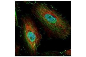 ICC/IF Image Confocal immunofluorescence analysis (Olympus FV10i) of paraformaldehyde-fixed HeLa, using BIVM, antibody (Green) at 1:500 dilution. (BIVM antibody  (C-Term))