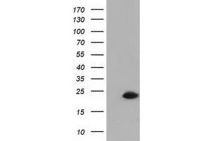 HEK293T cells were transfected with the pCMV6-ENTRY control (Left lane) or pCMV6-ENTRY RBBP9 (Right lane) cDNA for 48 hrs and lysed. (RBBP9 antibody)