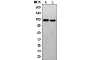 Western blot analysis of c-FER expression in Jurkat (A), HeLa (B) whole cell lysates. (FER antibody  (C-Term))