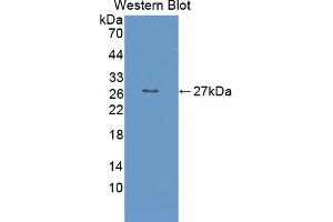 Western blot analysis of the recombinant protein. (EBI3 antibody  (AA 19-228))