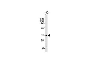 Western blot analysis of lysate from RD cell line,using EDA Antibody (N-term) (ABIN390232 and ABIN2840705). (Ectodysplasin A antibody  (N-Term))