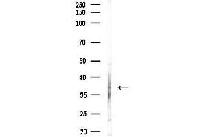 anti-Purinergic Receptor P2Y, G-Protein Coupled, 12 (P2RY12) (N-Term) antibody