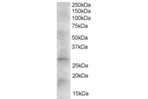 Western Blotting (WB) image for anti-Dickkopf 2 Homolog (DKK2) (C-Term) antibody (ABIN2465604) (DKK2 antibody  (C-Term))