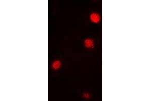 Immunofluorescent analysis of Ataxin 3 staining in Jurkat cells. (Ataxin 3 antibody)