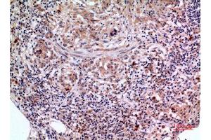 Immunohistochemistry (IHC) analysis of paraffin-embedded Human Lung, antibody was diluted at 1:100. (SCCA1/2 (Internal Region) antibody)