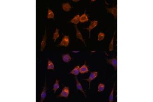 Immunofluorescence analysis of L929 cells using AVIL antibody (ABIN7265508) at dilution of 1:100. (Advillin antibody  (AA 470-819))